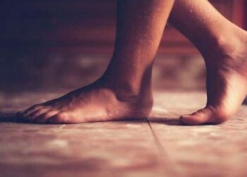 5 أطعمة تضاعف خطر الإصابة بـ”داء الملوك” و5 أخرى تخفف من أعراضه