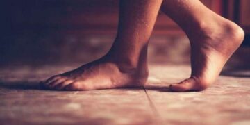 5 أطعمة تضاعف خطر الإصابة بـ”داء الملوك” و5 أخرى تخفف من أعراضه