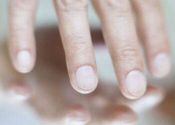 الألمان يبتكرون طريقة لكشف السرطان من حالة الأظافر