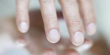 الألمان يبتكرون طريقة لكشف السرطان من حالة الأظافر