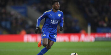 الإصابة تبعد نديدي عن لقاءات ليستر سيتي