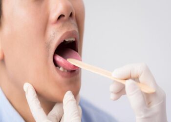 اللسان يمكن أن يكشف عن نقص معدن هام في الجسم