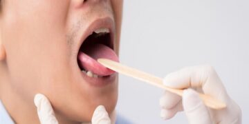 اللسان يمكن أن يكشف عن نقص معدن هام في الجسم