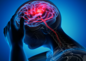 سعالها المزمن تسبب في إصابتها بنوع نادر ومهدد للحياة من السكتة الدماغية!