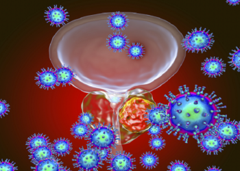 “صاروخ” يستهدف أورام البروستات وقد يطيل متوسط العمر المتوقع!