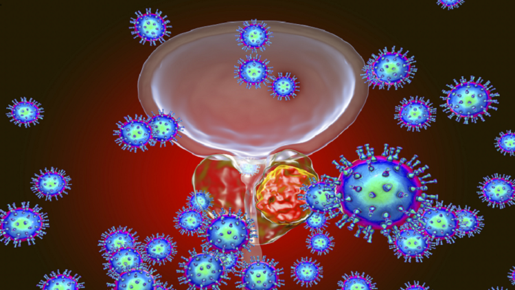 “صاروخ” يستهدف أورام البروستات وقد يطيل متوسط العمر المتوقع!