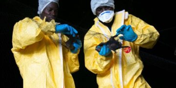 مكتشف إيبولا يتحدث عن سبب انتشار الأمراض