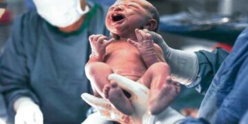 ولادة أول طفل بعد عملية زرع رحم …