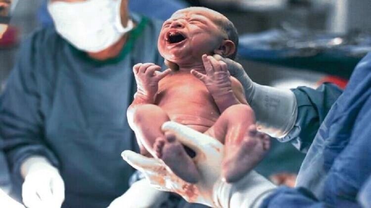 ولادة أول طفل بعد عملية زرع رحم …